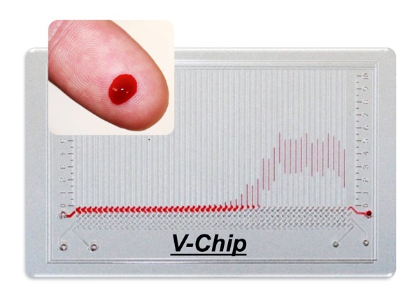 Esami_sangue_InnovativaMENTE_Daniele_Pirotta1